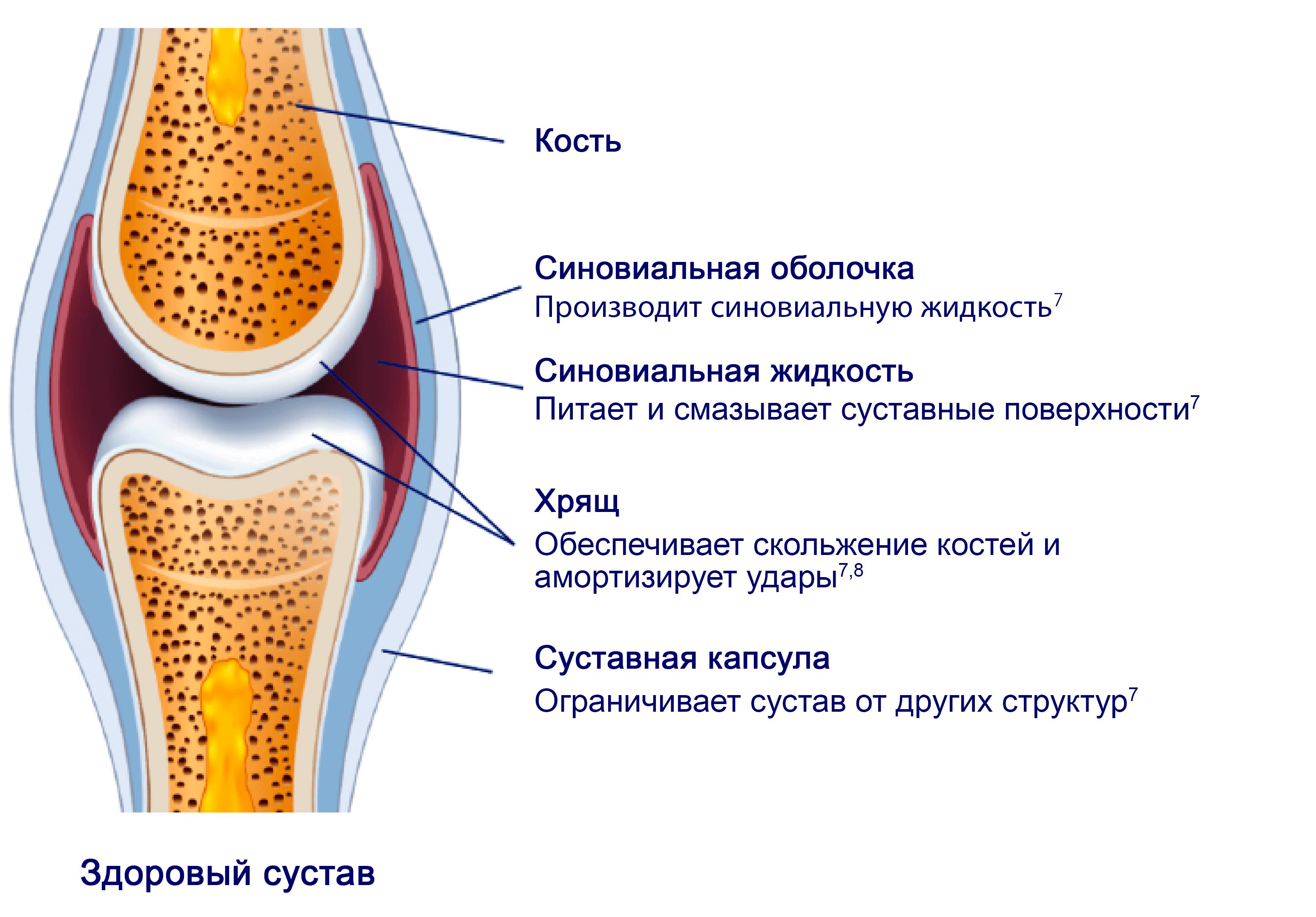 articulation sans arthrose