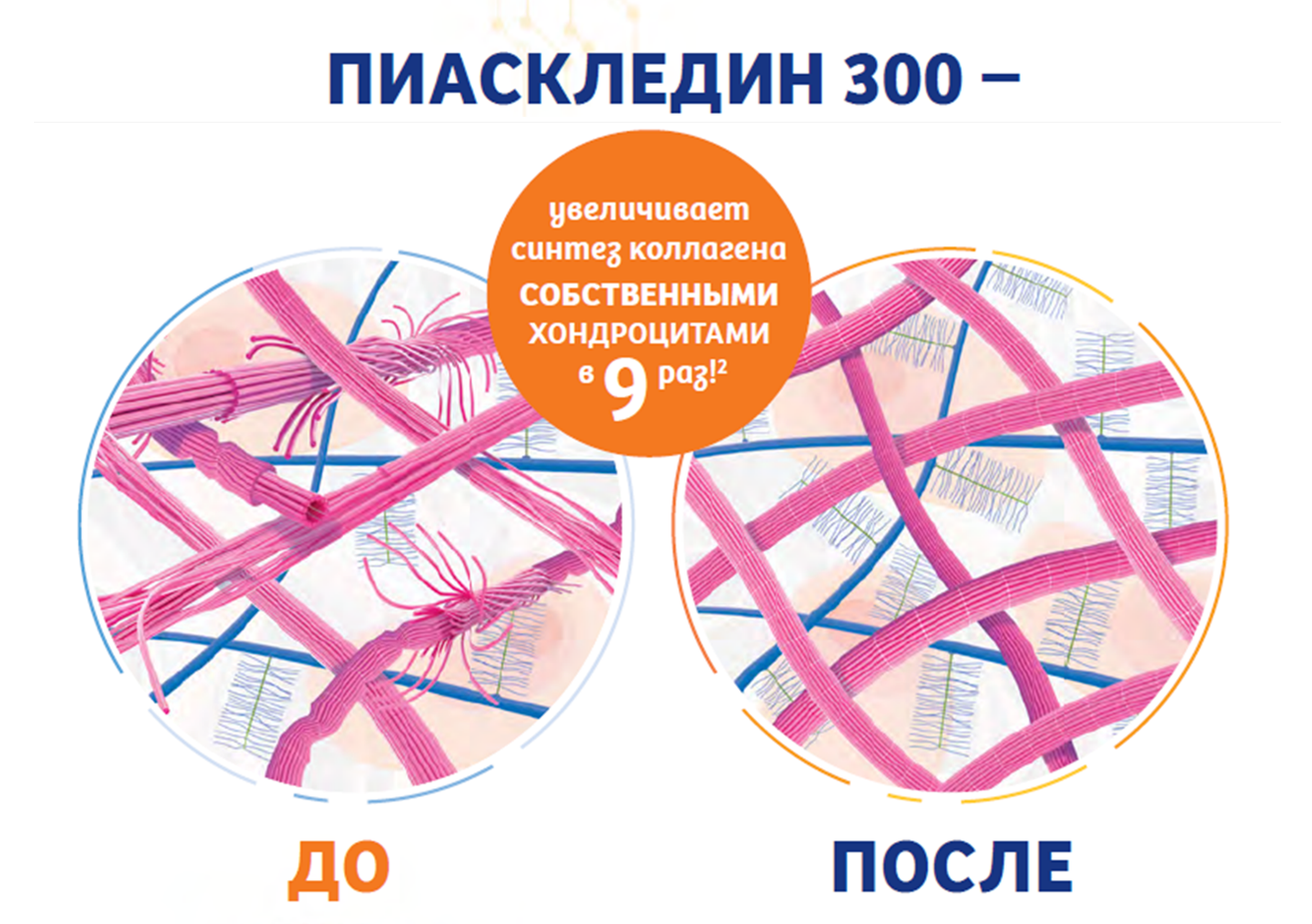 как работает Пиаскледин 300
